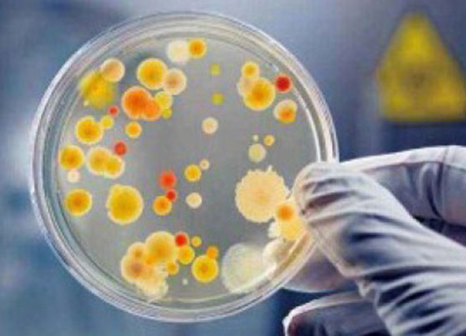 原位有机传染场地建复- 强化微生物建复